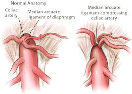 arcuate