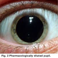 dilate