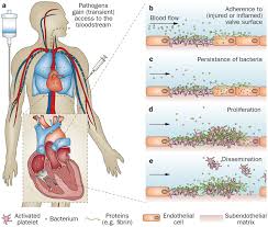 infective